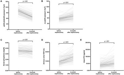 Alterations in the Mineral Bone Metabolism of Living Kidney Donors After Uni-Nephrectomy: Prospective Observational Study